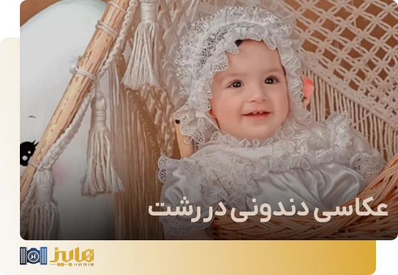 عکاسی دندونی در رشت